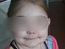 Врачи из Новосибирска спасают жизнь 8-летней иностранке с почечной недостаточностью