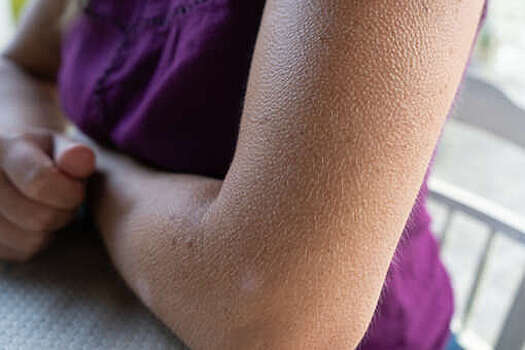 PNAS: клетки кожи общаются друг с другом с помощью ионов кальция