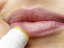 Герпес на губах: симптомы, лечение, выбор мази