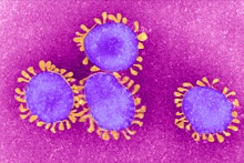 Российские ученые научились обезвреживать коронавирус с помощью наночастиц