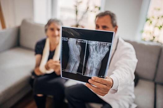 Хирург из Парижа попался на попытке продажи рентген-снимка жертвы «Батаклана» на NFT-бирже: Новости ➕1, 24.01.2022