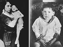 23 января 1922 года была сделана первая инъекция инсулина человеку, которая спасла ему жизнь