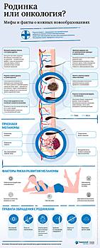 Мифы и факты о родинках