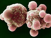 Эксперимент помог пациентам избавиться от стареющих клеток