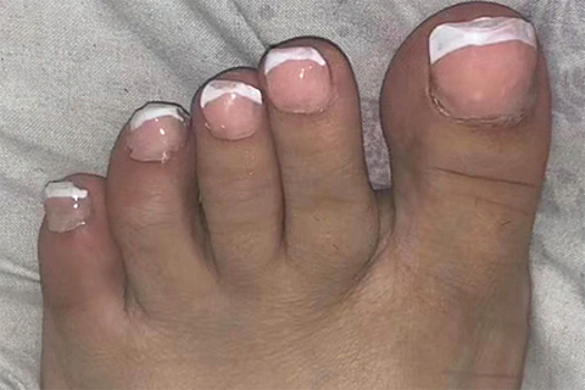 Блогерша пришла на педикюр и осталась с кривыми ногтями