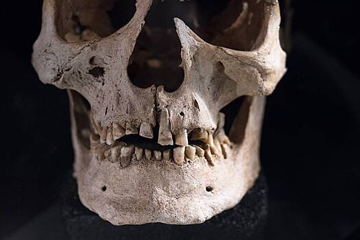Как викинги в X-XII веках пытались лечить болезни зубов