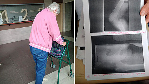 В Тольятти попавшая в ДТП пенсионерка семь лет пытается добиться медпомощи