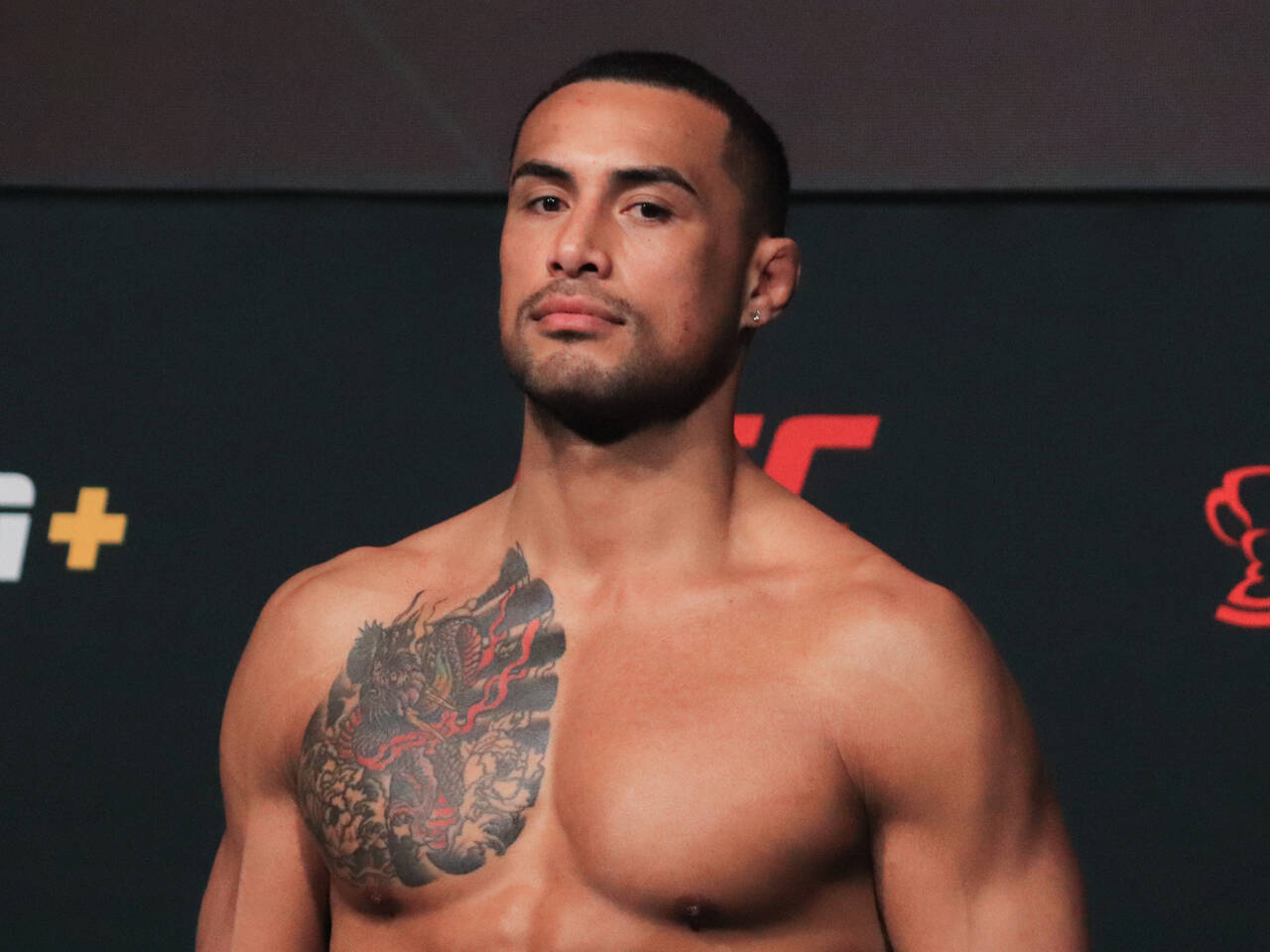 Новоиспеченный чемпион UFC Карлос Ульберг перенес операцию на травмированной ноге.