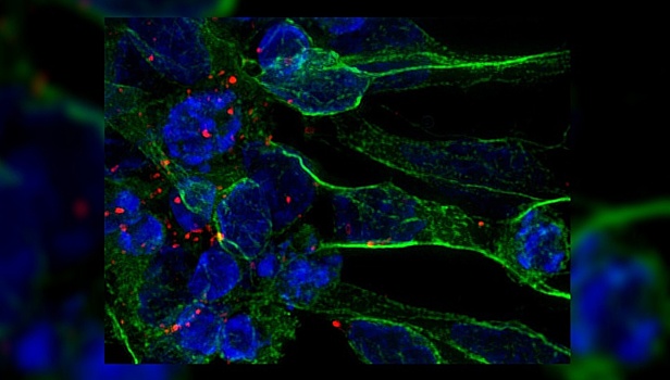 Стволовые клетки помогут восстановить мозг после инсульта