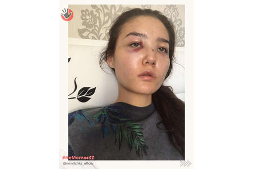 Жена сотрудника МИД Казахстана обвинила его в избиениях ее и сестры
