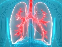 Смех может рассказать о раке лёгких