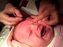 Слезы младенца во спасение: в Перми сделана сложнейшая операция