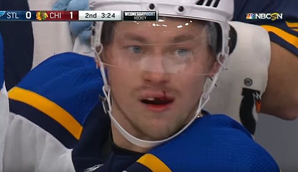 Кровавая улыбка Тарасенко, Кузнецов получил травму головы. Все о дне НХЛ (видео)