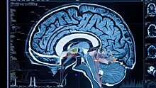 ИИ научился распознавать сотрясение мозга по МРТ с точностью в 99%