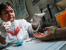 17 признаков сахарного диабета