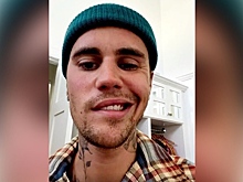 Джастин Бибер раскрыл диагноз, из-за которого у него перекосило лицо