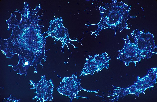 Нарушение суточного биоритма ускоряет рост опухолей