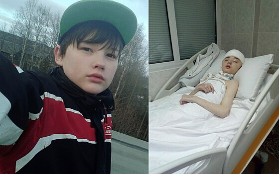 Северодвинский школьник Иван Крапивин, покалеченный пьяным соседом, скончался в Москве