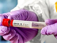Почти все ПЦР-тесты на ковид на Украине оказались российскими