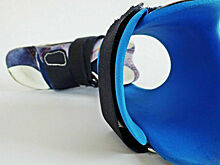 Депутат объяснила, зачем нужен стандарт ортезирования