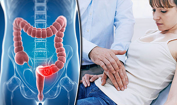 Гастроэнтеролог назвал первый симптом рака кишечника