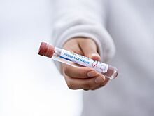 В Ростовской области за сутки COVID-19 подтвердился у 2950 человек