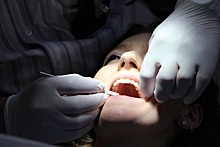 Стоматолог-ортопед объяснил, когда нельзя ставить виниры