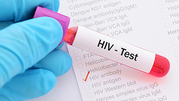 16 волнующих вопросов про ВИЧ, которые вы стеснялись задать