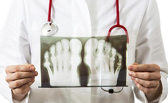 Профессор Виктор Процко: Стопа предупредит о возможной болезни Паркинсона