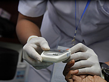 Назван необычный симптом опасного уровня холестерина