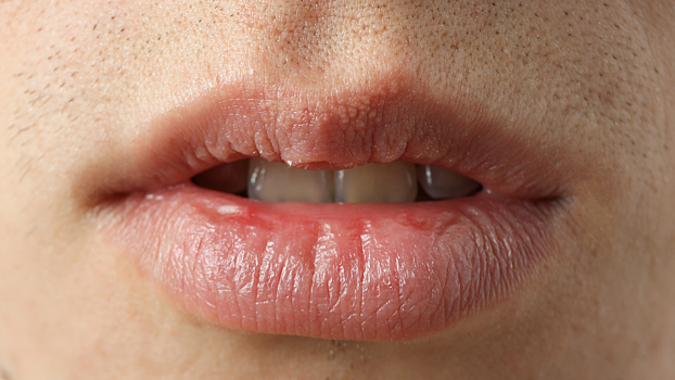 От чего бывает сухость во рту и чем это опасно: рассказывает врач