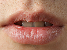 От чего бывает сухость во рту и чем это опасно: рассказывает врач