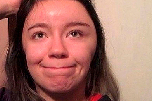 Девушка проснулась с головой в форме мяча