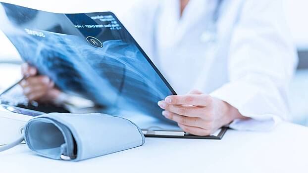 Российские студенты нашли новый способ распознавать рак легких