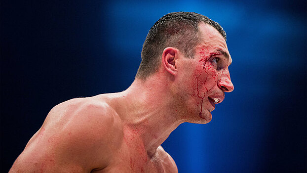 «Это больше психологическое». Экс-тренер о проигрыше Кличко Фьюри