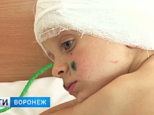 Владелец ротвейлера, напавшего на ребёнка: «Что теперь собаку усыплять? Или меня?»