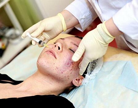 Как работа желудка влияет на кожу: ответ гастроэнтеролога