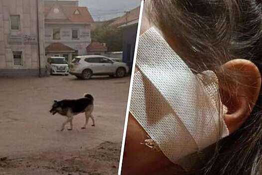 В Улан-Удэ на женщину с ребенком напала собака, девочка пострадала