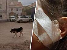 В Улан-Удэ на женщину с ребенком напала собака, девочка пострадала