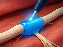 Новый биоклей сделает хирургические швы пережитком прошлого