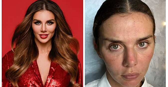 Разница на лицо: как российские знаменитости выглядят без макияжа