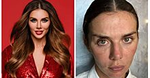 Разница на лицо: как российские знаменитости выглядят без макияжа