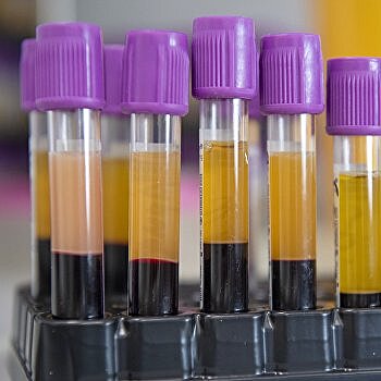 В «Борисполе» установили лабораторию для тестирования на COVID-19, но не для всех