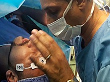 В Иране анестезию заменяют на гипноз