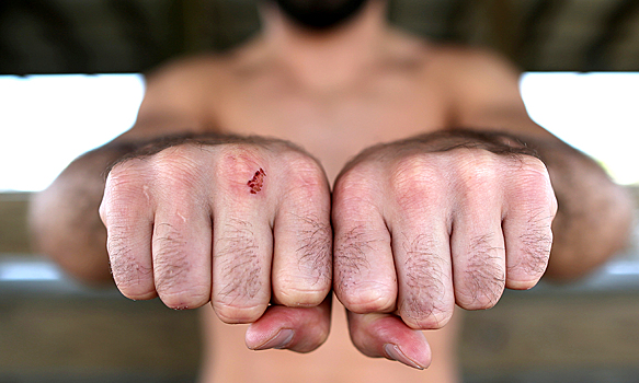 UFC обвинили в «ограблении» бойцов