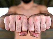 UFC обвинили в «ограблении» бойцов
