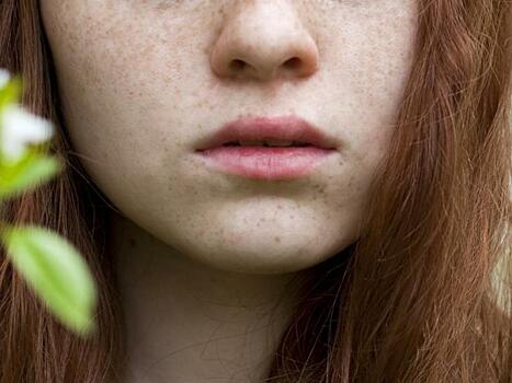 Что такое заеды и как с ними бороться