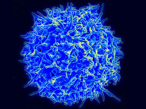 Найдена молекула, заставляющая иммунные клетки эффективнее уничтожать "твёрдый" рак