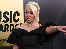 Рудковская рассказала об отношении к ботоксу