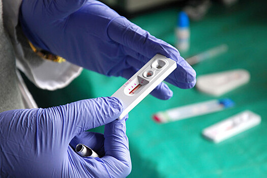 В Минздраве назвали ограничение для вакцинации ВИЧ-инфицированных